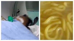 9 Orang 1 Keluarga Meninggal karena Makan Mie yang Disimpan di Freezer, Terkontaminasi Asam Bongkrek