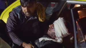 Sedikitnya ratusan orang terluka akibat dua ledakan bom bunuh diri di Bandara Kabul.